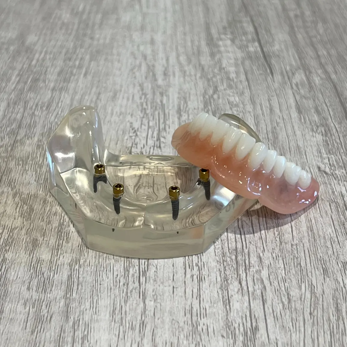 snap-in implant dentures | dental implants in Redondo Beach, CA