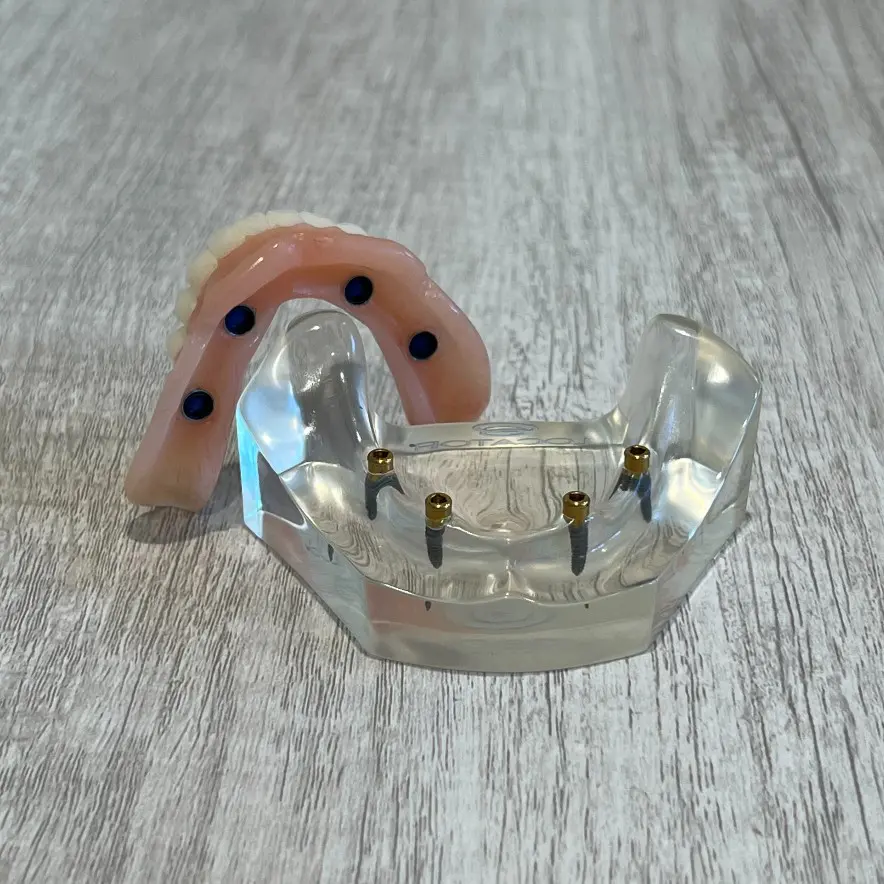 snap-in implant dentures in Redondo Beach, CA